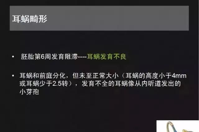 影像PPT - 【PPT】先天性内耳畸形影像学诊断-20