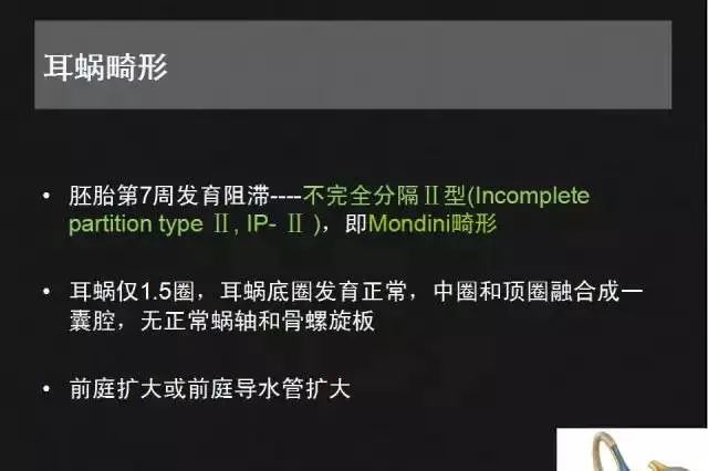 影像PPT - 【PPT】先天性内耳畸形影像学诊断-22