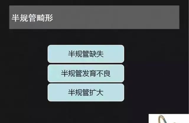 影像PPT - 【PPT】先天性内耳畸形影像学诊断-27