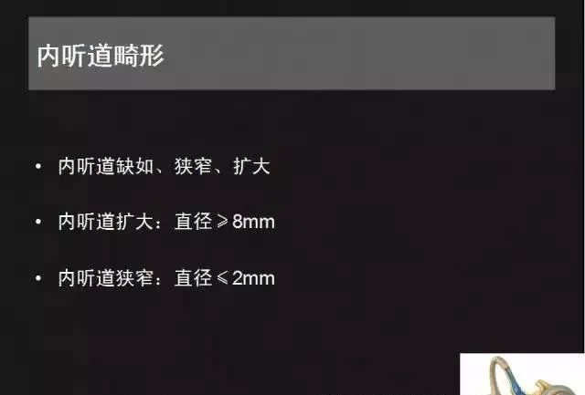 影像PPT - 【PPT】先天性内耳畸形影像学诊断-32