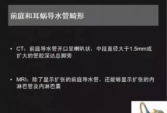影像PPT - 【PPT】先天性内耳畸形影像学诊断-34