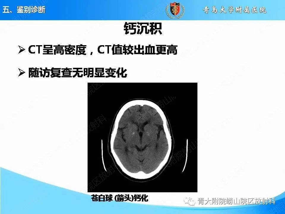影像PPT - 【PPT】淀粉样脑血管病的影像诊断与鉴别诊断-56