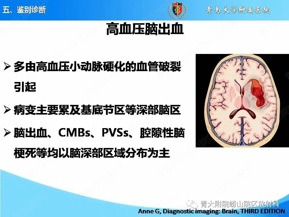 影像PPT - 【PPT】淀粉样脑血管病的影像诊断与鉴别诊断-68