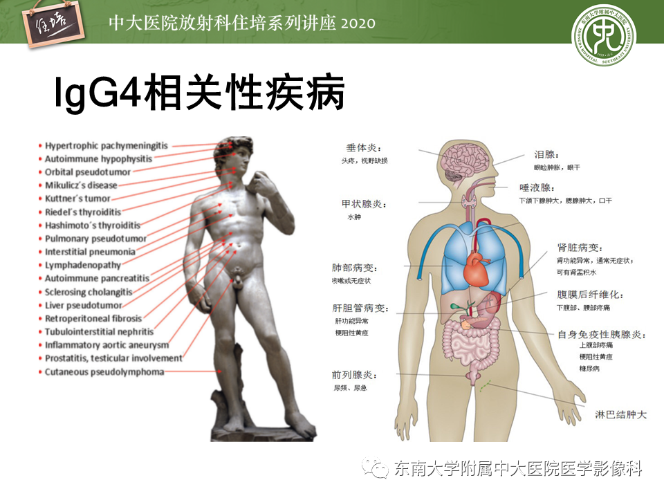 影像PPT - 【PPT】IgG4相关性疾病腹部脏器累及影像表现-4