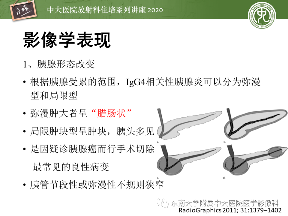 影像PPT - 【PPT】IgG4相关性疾病腹部脏器累及影像表现-10