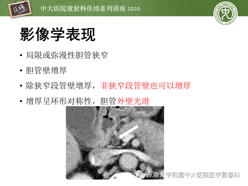 影像PPT - 【PPT】IgG4相关性疾病腹部脏器累及影像表现-21