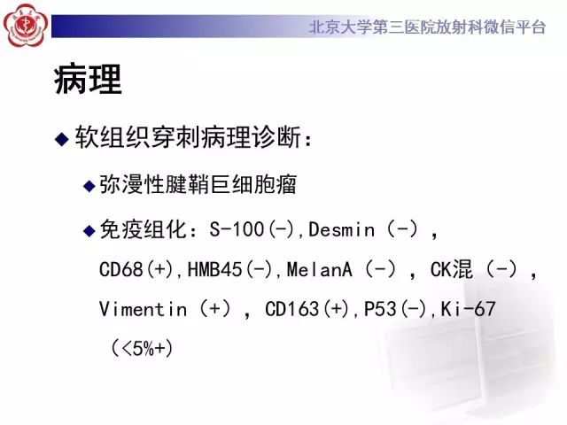 影像PPT - 【PPT】脊柱腱鞘巨细胞瘤TGCT影像-9