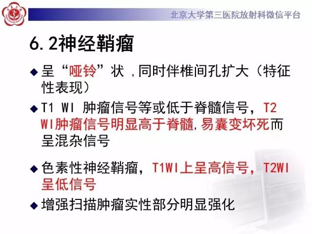 影像PPT - 【PPT】脊柱腱鞘巨细胞瘤TGCT影像-20
