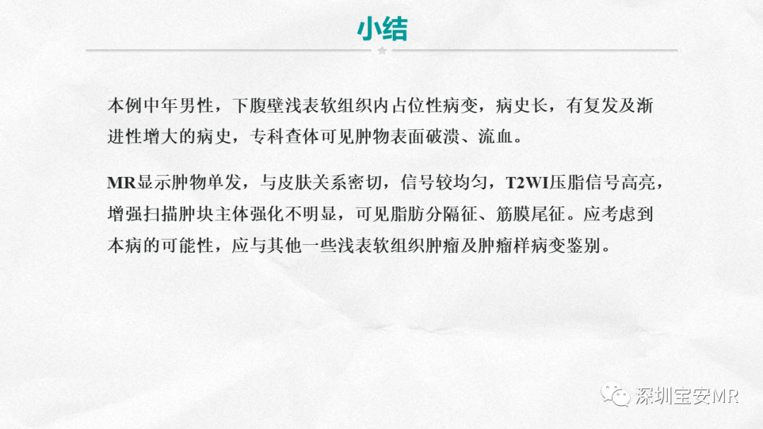 影像PPT - 【PPT】隆突性皮肤纤维肉瘤-24