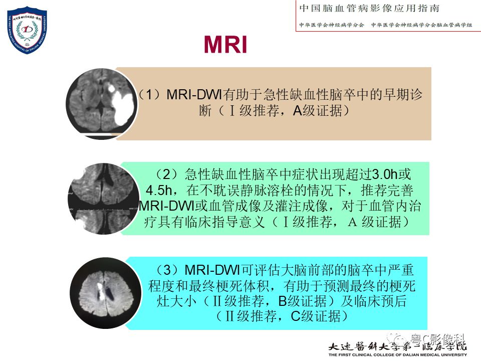 影像PPT - 【PPT】急性脑卒中影像学评估中容易被忽略的征象-7