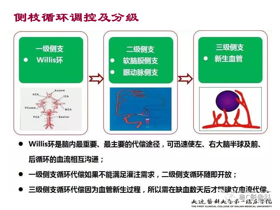 影像PPT - 【PPT】急性脑卒中影像学评估中容易被忽略的征象-31