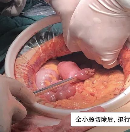 影像PPT - 七旬老人遭遇“死神之征”-5 影像PPT - 七旬老人遭遇“死神之征”-5