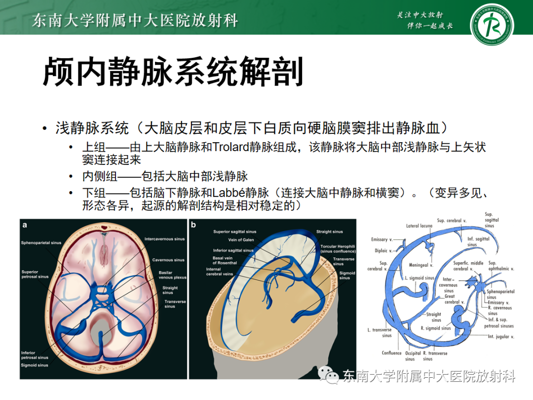 影像PPT - 【PPT】颅内静脉血栓影像诊断-13