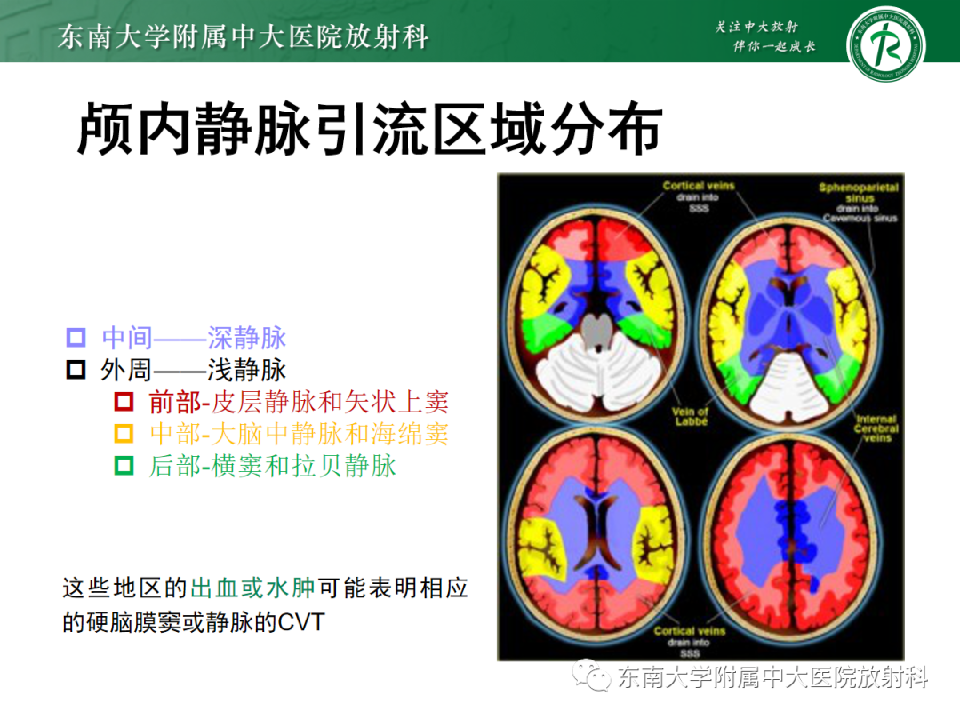 影像PPT - 【PPT】颅内静脉血栓影像诊断-15