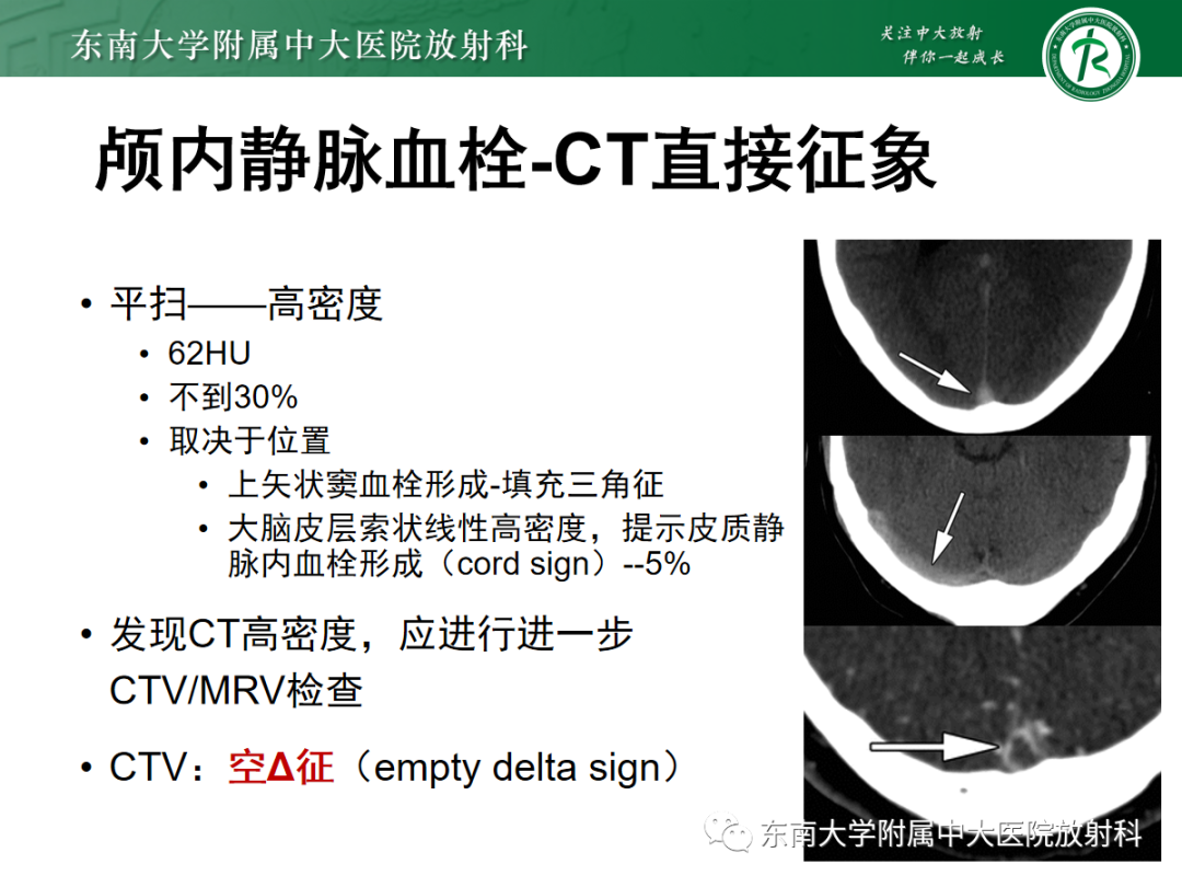 影像PPT - 【PPT】颅内静脉血栓影像诊断-20