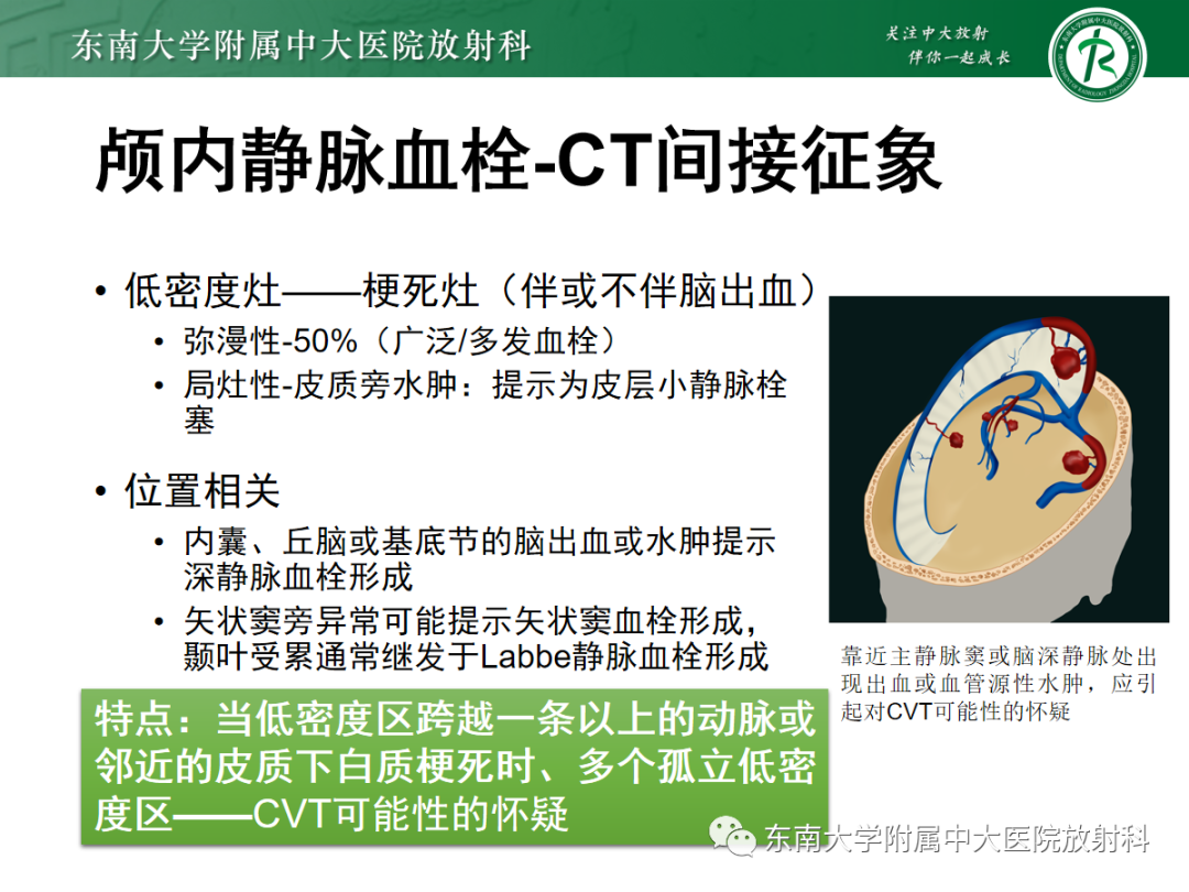 影像PPT - 【PPT】颅内静脉血栓影像诊断-21