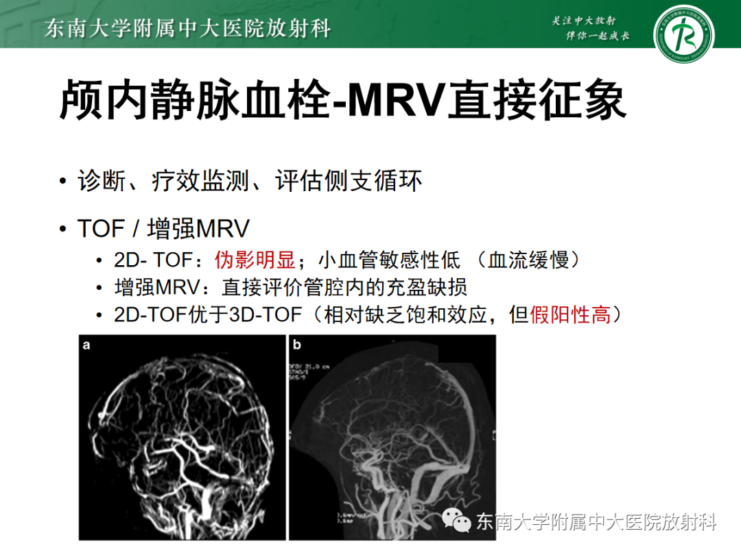 影像PPT - 【PPT】颅内静脉血栓影像诊断-25