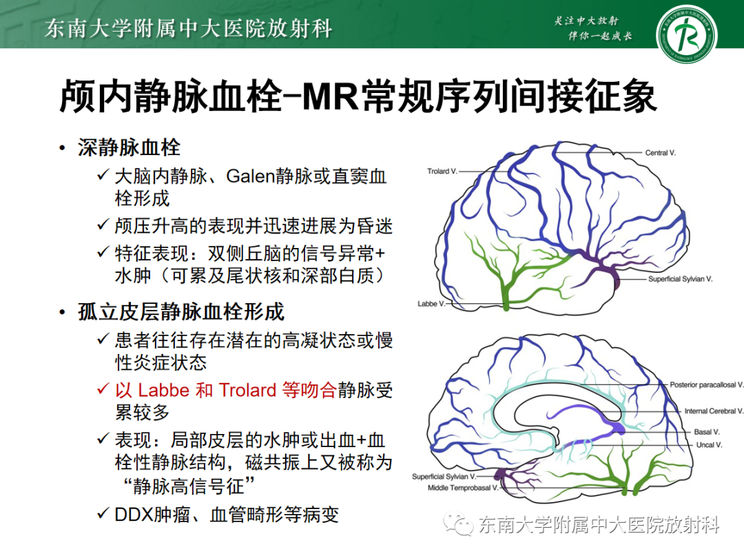 影像PPT - 【PPT】颅内静脉血栓影像诊断-28