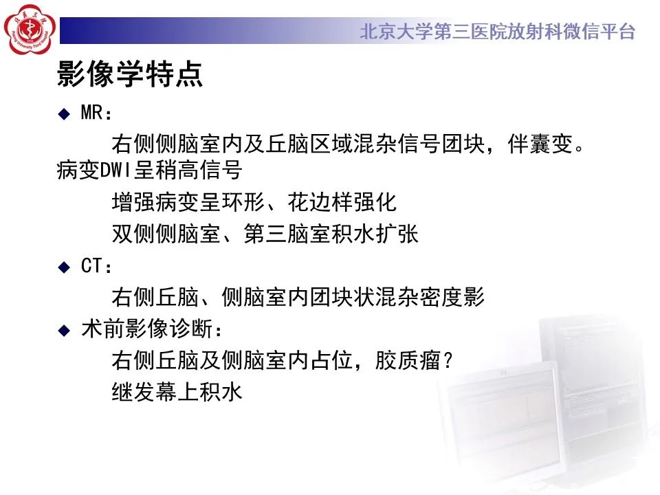 影像PPT - 【病例】弥漫性中线胶质瘤1例CT及MR-7