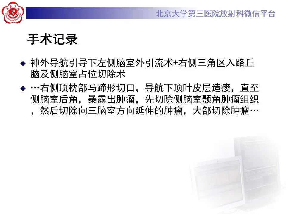 影像PPT - 【病例】弥漫性中线胶质瘤1例CT及MR-8