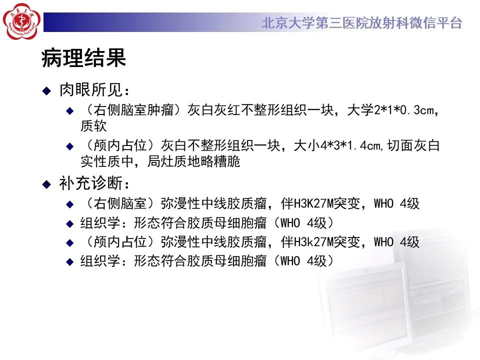 影像PPT - 【病例】弥漫性中线胶质瘤1例CT及MR-9