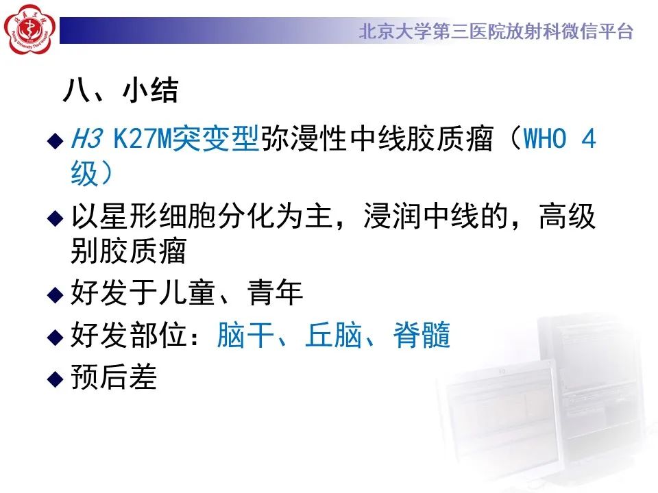 影像PPT - 【病例】弥漫性中线胶质瘤1例CT及MR-18