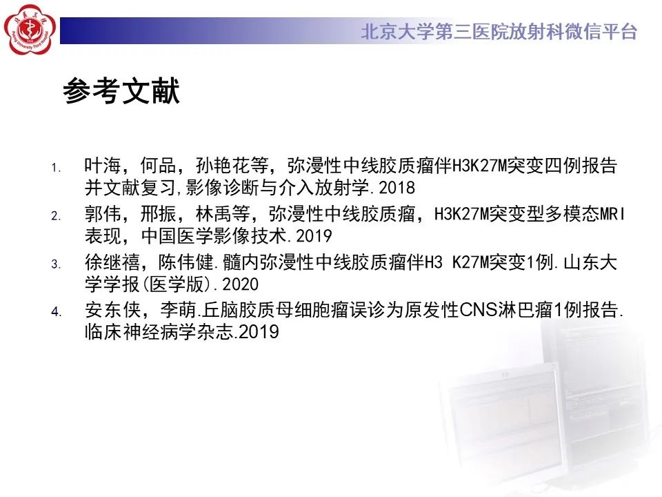 影像PPT - 【病例】弥漫性中线胶质瘤1例CT及MR-19