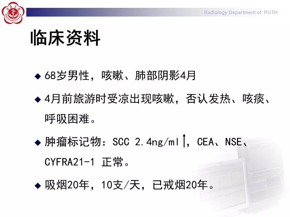 影像PPT - 【PPT】肺黏液表皮样癌（PMEC）影像-2