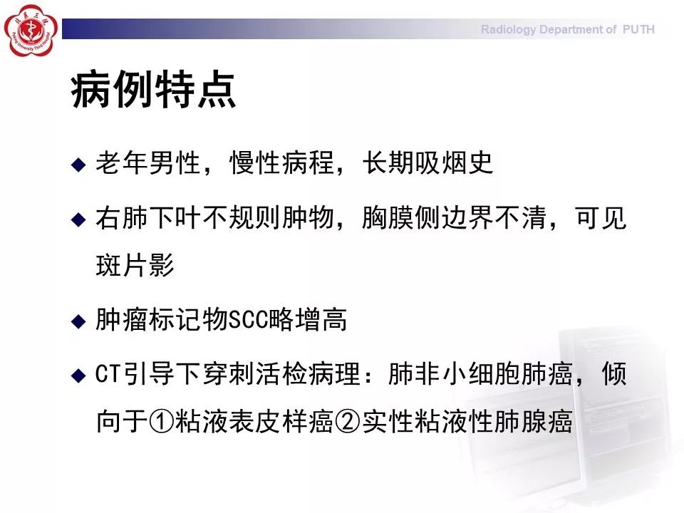 影像PPT - 【PPT】肺黏液表皮样癌（PMEC）影像-7