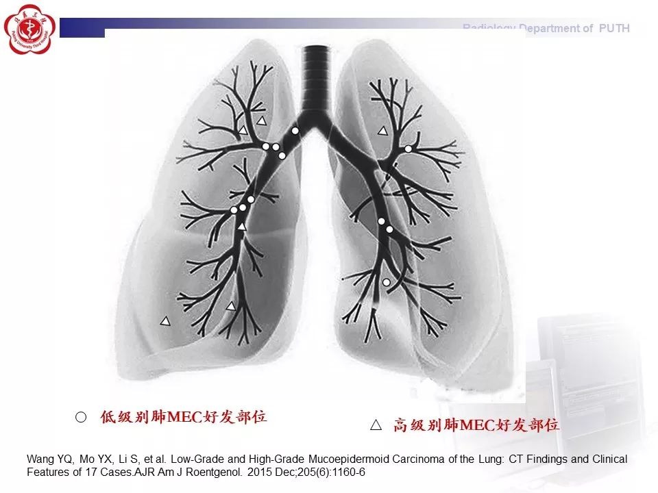 影像PPT - 【PPT】肺黏液表皮样癌（PMEC）影像-15
