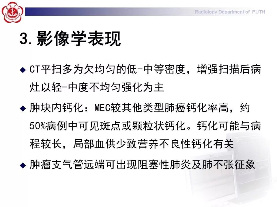 影像PPT - 【PPT】肺黏液表皮样癌（PMEC）影像-19