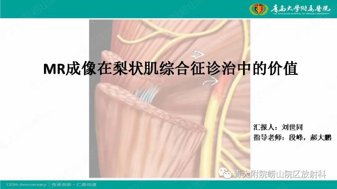 影像PPT - 【PPT】MR成像在梨状肌综合征诊治中的价值-1