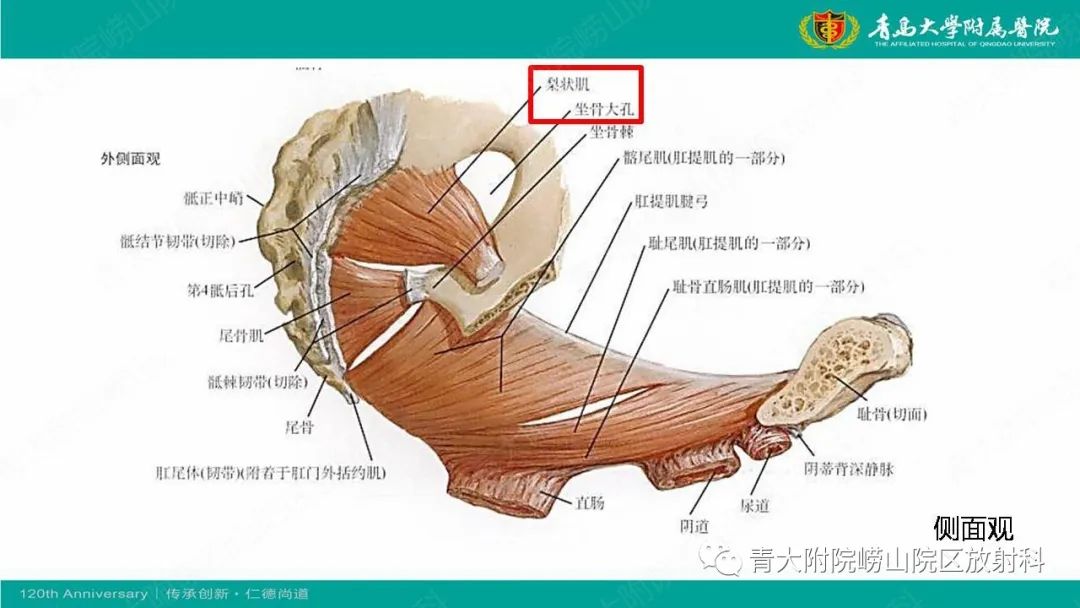 影像PPT - 【PPT】MR成像在梨状肌综合征诊治中的价值-4