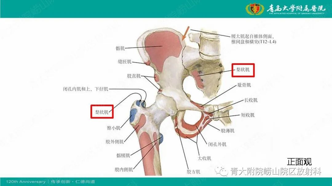 影像PPT - 【PPT】MR成像在梨状肌综合征诊治中的价值-5