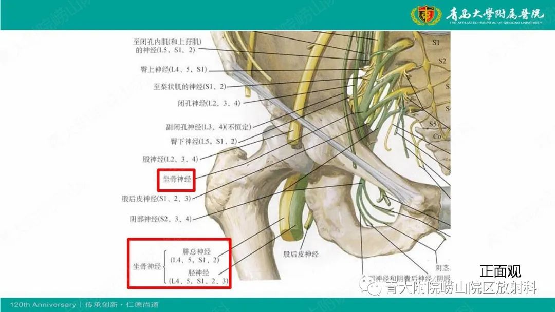 影像PPT - 【PPT】MR成像在梨状肌综合征诊治中的价值-6
