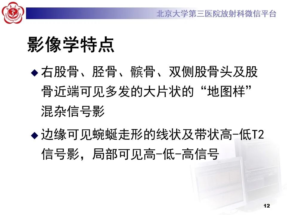 影像PPT - 【PPT】骨梗死的影像-11