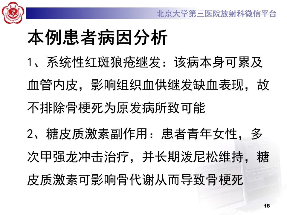 影像PPT - 【PPT】骨梗死的影像-17