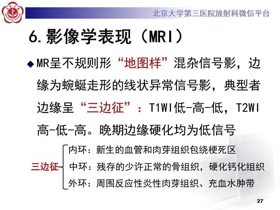 影像PPT - 【PPT】骨梗死的影像-26