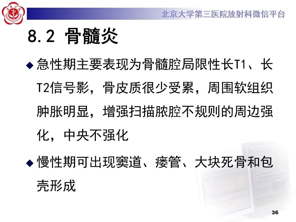影像PPT - 【PPT】骨梗死的影像-35