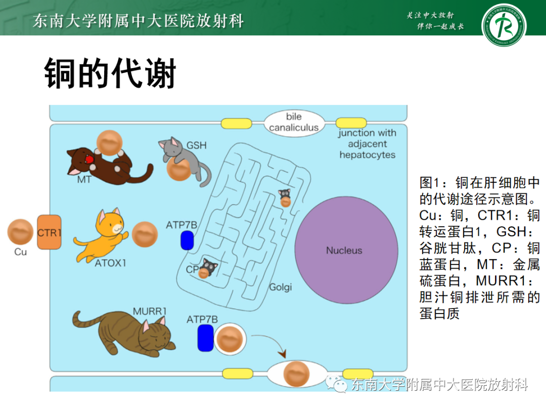 影像PPT - 【PPT】肝豆状核变性-6