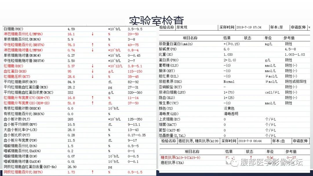影像PPT - 【病例】肾脏浸润性尿路上皮癌2例CT-3