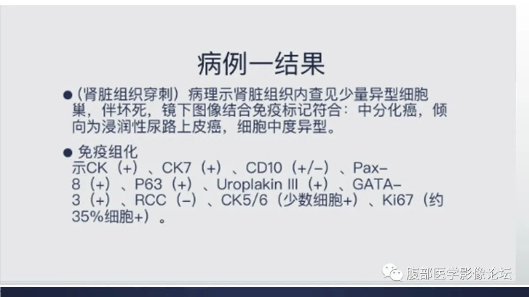 影像PPT - 【病例】肾脏浸润性尿路上皮癌2例CT-14