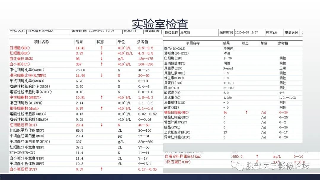 影像PPT - 【病例】肾脏浸润性尿路上皮癌2例CT-16