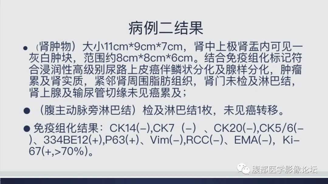影像PPT - 【病例】肾脏浸润性尿路上皮癌2例CT-25