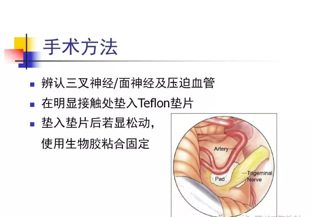 影像PPT - 【PPT】3D-TOF-MRA在三叉神经面肌抽搐综合征中的应用-14
