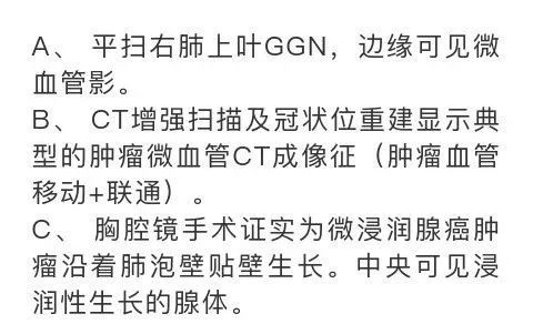 影像PPT - 【PPT】肺腺癌的十类形态学分型-4