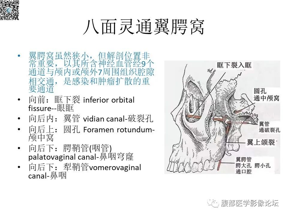 影像PPT - 【PPT】颅骨颅底系列之八面灵通翼腭窝-5
