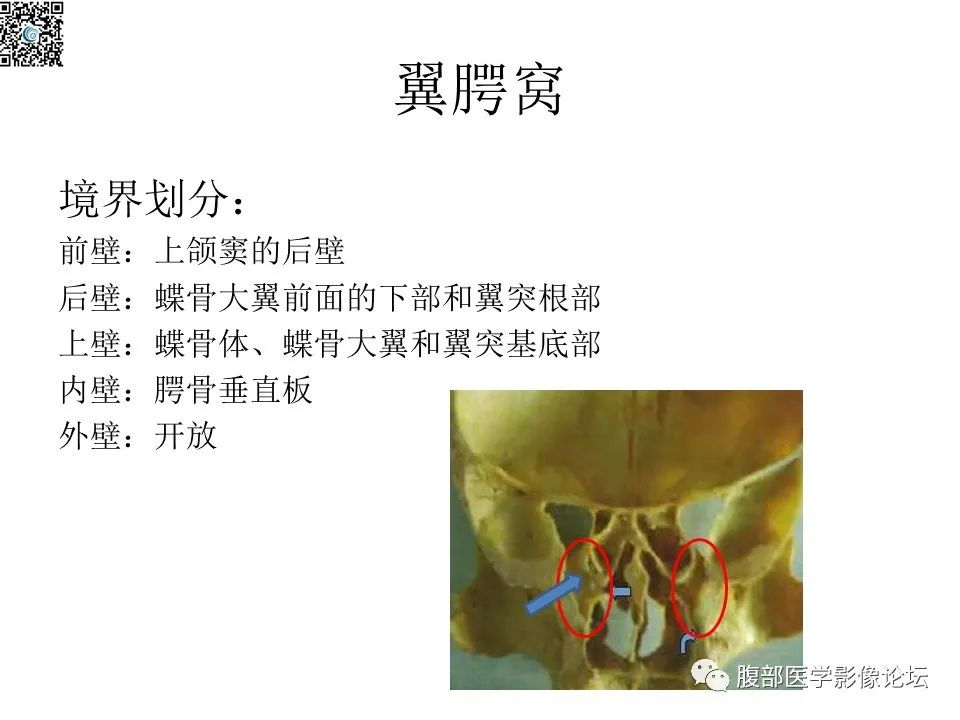 影像PPT - 【PPT】颅骨颅底系列之八面灵通翼腭窝-4