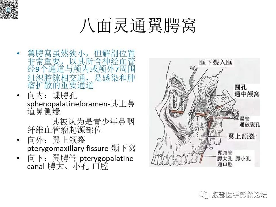 影像PPT - 【PPT】颅骨颅底系列之八面灵通翼腭窝-6