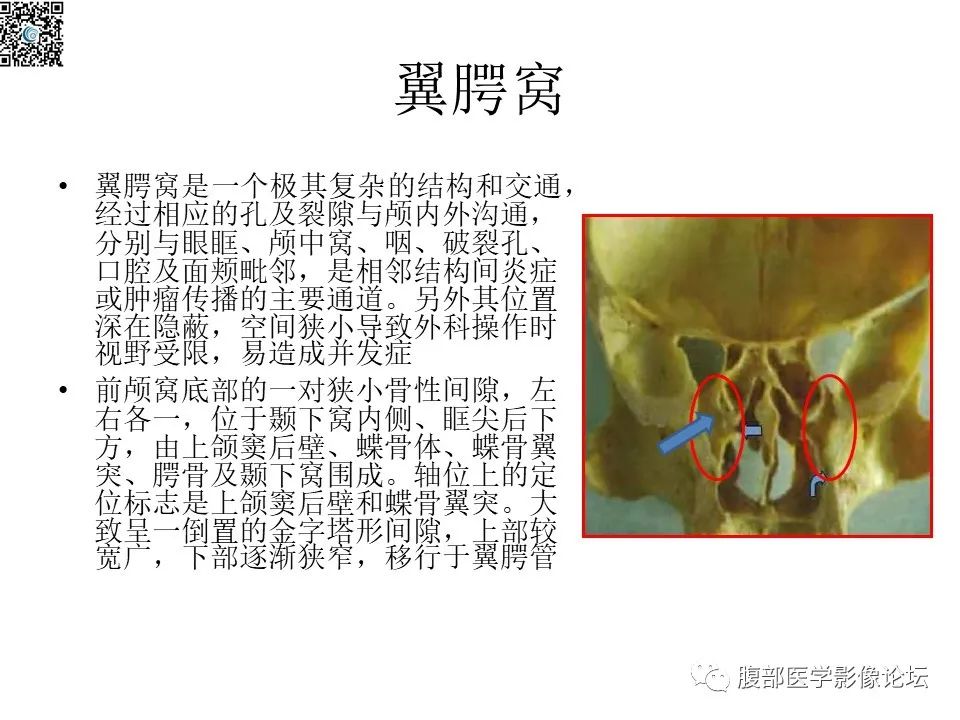 影像PPT - 【PPT】颅骨颅底系列之八面灵通翼腭窝-2